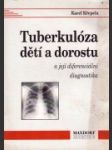 Tuberkulóza dětí a dorostu a její diferenciální diagnostika - náhled