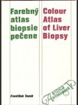 Farebný atlas biopsie pečene - náhled